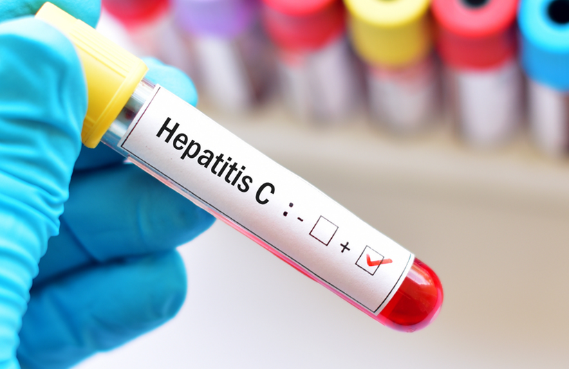 Диагностика гепатит C